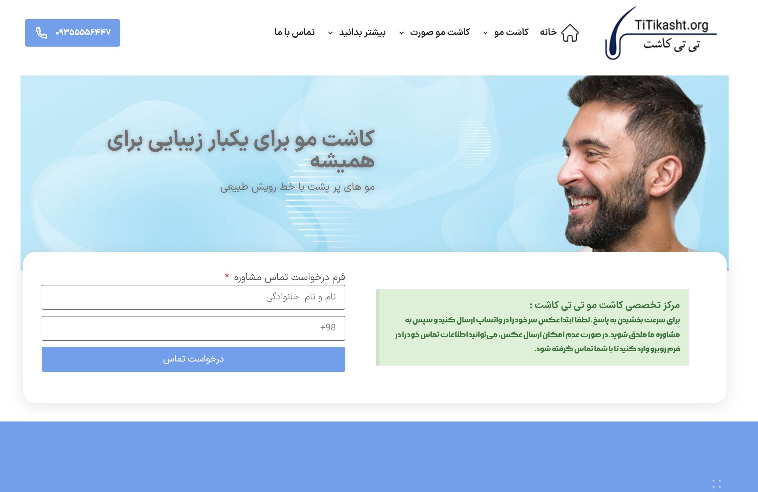 همکاری با کلینیک معتبر کاشت مو تی تی کاشت